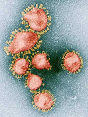 The SARS virus